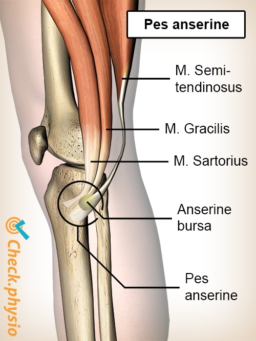 Knie Pes-anserinus Schleimbeutel Bursa Sartorius Gracilis Semitendinosus Sehnen Gänsefuss-Syndrom