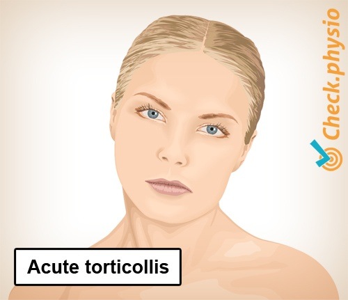 Hals Torticollis abnormal Haltung