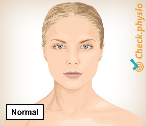 Hals Torticollis normale Haltung