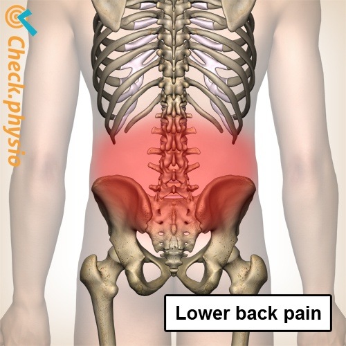 Rücken unterer Rückenschmerz Wirbelsäule Skelett