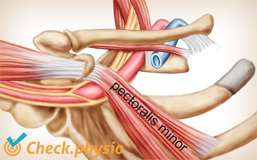 Schulter Arm Hand TOS Thoracic-Outlet-Syndrom Musculus pectoralis minor