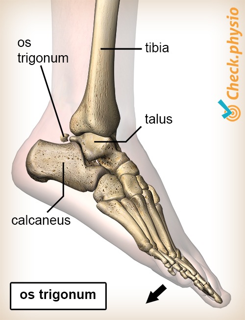 Knöchel posteriores Impingement Os Trigonum