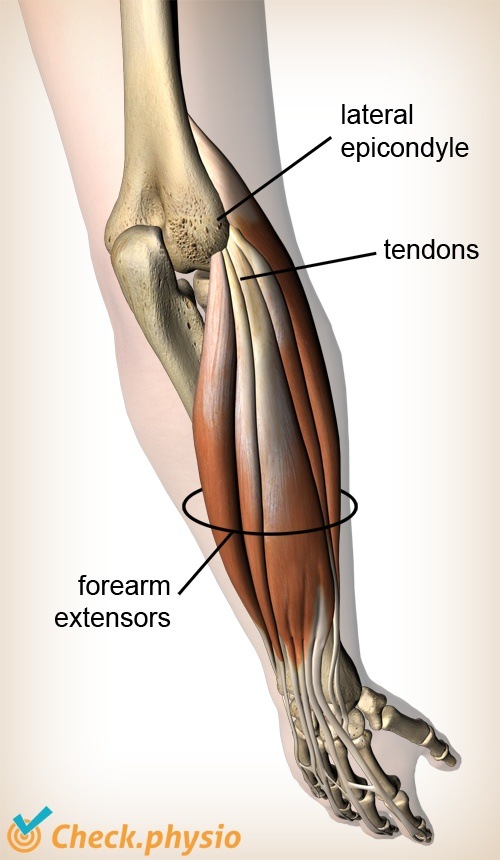 arm Extensoren