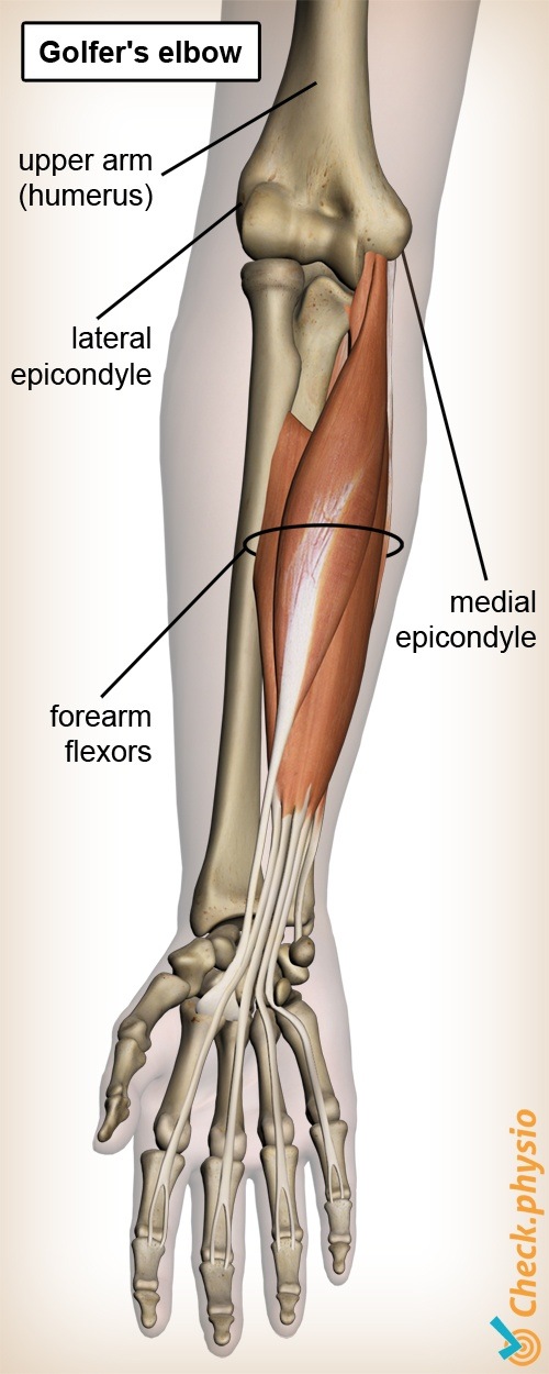 arm Golferarm Anatomie