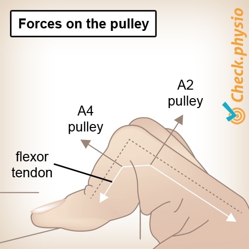 Hand Finger Pulleys Traktionskräfte