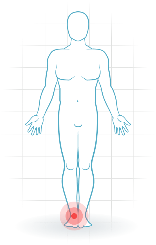 pijnlocatie Anteriores Knöchel-Impingement