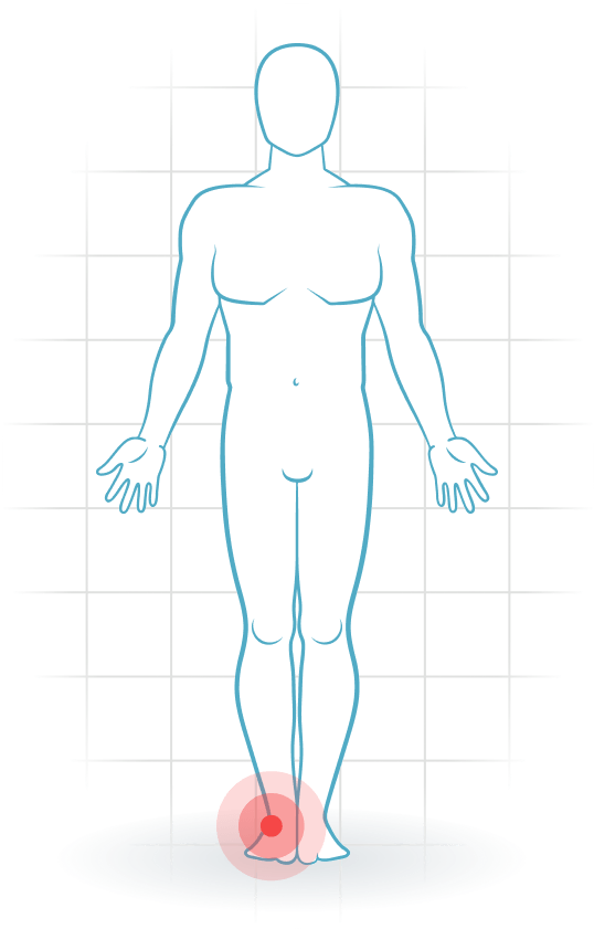 pijnlocatie Laterale Knöchelbandverletzung