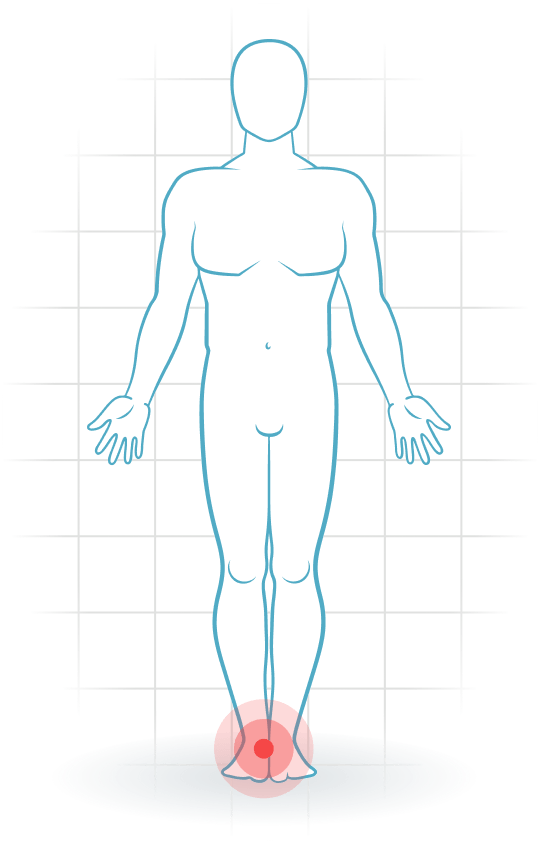pijnlocatie Mediales Knöchelband-Verletzung